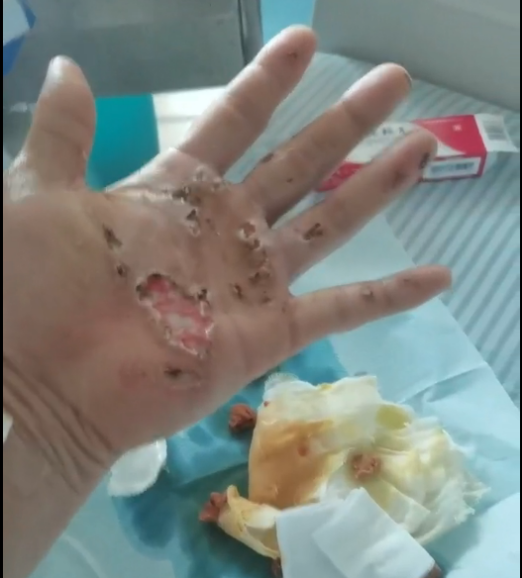  广东省市场监管局：垂钓安全不容忽视
